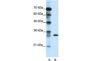 WB Suggested Anti-TSFM Antibody Titration:  1. (TSFM antibody  (C-Term))