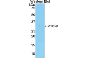 Detection of Recombinant F5, Mouse using Polyclonal Antibody to Coagulation Factor V (F5) (Coagulation Factor V antibody  (AA 1776-2028))