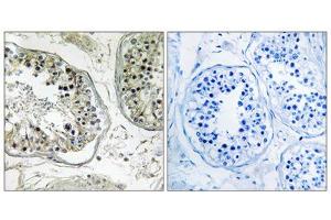 Immunohistochemistry analysis of paraffin-embedded human testis tissue, using CHST13 antibody. (CHST13 antibody  (Internal Region))