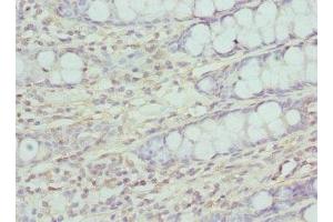 Immunohistochemistry of paraffin-embedded human colon tissue using ABIN7147359 at dilution of 1:100 (CG1331 Gene Product From Transcript CG1331-RA (CCP84AF) (AA 1-280) antibody)