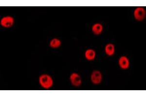 ABIN6274044 staining Hela by IF/ICC. (RNF20 antibody  (Internal Region))