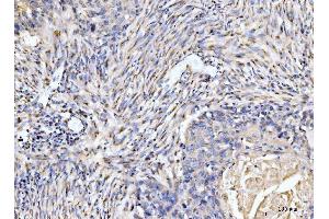 IHC analysis of Giantin/GOLGB1 using anti-Giantin/GOLGB1 antibody (ABIN7600139). (Golgin B1 (GOLGB1) (AA 153-950) antibody)