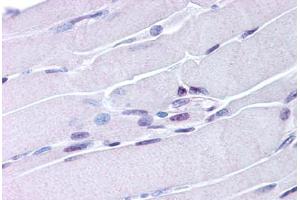 Skeletal Muscle (NR4A1 antibody  (AA 251-266))
