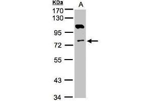 WB Image Sample(30 ug whole cell lysate) A:A431, 7. (Adenylate Kinase 7 antibody)