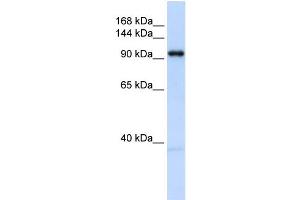 WB Suggested Anti-OGT Antibody Titration: 0. (OGT antibody  (N-Term))
