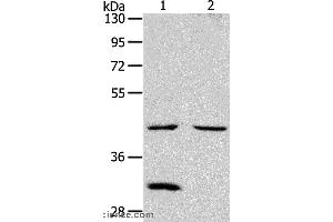 Western blot analysis of Mouse kidney and heart tissue, using NCEH1 Polyclonal Antibody at dilution of 1:1300 (NCEH1 antibody)