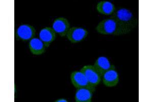 SH-SY-5Y cells were fixed in paraformaldehyde, permeabilized with 0. (EIF4E antibody  (pSer209))