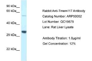 WB Suggested Anti-Tmem117 Antibody   Titration: 1. (TMEM117 antibody  (C-Term))