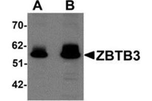 Western blot analysis of ZBTB3 in rat brain tissue lysate with ZBTB3 antibody at (A) 1 and (B) 2 μg/ml. (ZBTB3 antibody  (C-Term))