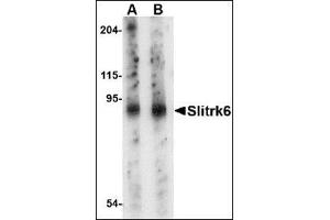 Western blot analysis of Slitrk6 in mouse lung tissue lysate with this product at (A) 0. (SLITRK6 antibody  (Center))