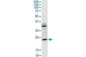 CD247 MaxPab rabbit polyclonal antibody. (CD247 antibody  (AA 1-164))