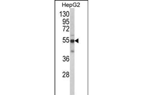 CYP2J2 antibody  (N-Term)