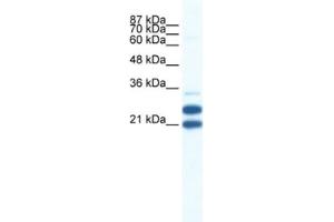 Western Blotting (WB) image for anti-Tripartite Motif Containing 34 (TRIM34) antibody (ABIN2461044)