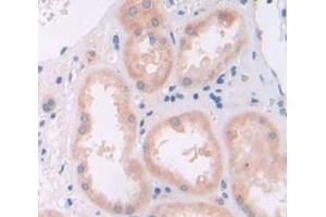 IHC-P analysis of Human Tissue, with DAB staining. (HGF antibody  (AA 32-291))
