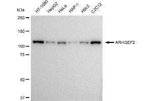 Western blotting analysis using ARHGEF2 antibody (ABIN7800207). (Recombinant ARHGEF2 antibody)