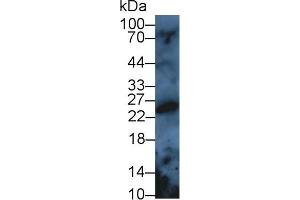 Detection of PRDX3 in Rat Serum using Polyclonal Antibody to Peroxiredoxin 3 (PRDX3) (Peroxiredoxin 3 antibody  (AA 5-233))
