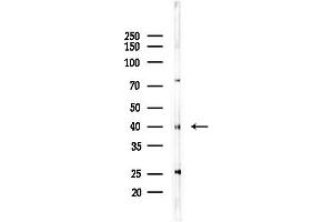 Western blot analysis of lysates from LoVo cells(heat-shock,45 min treatment), using REQU Antibody at 1/1000 dilution.