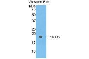 Detection of Recombinant CEA, Human using Polyclonal Antibody to Carcinoembryonic Antigen (CEA) (CEA antibody  (AA 93-221))