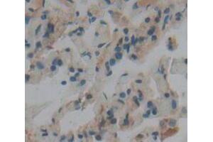 IHC-P analysis of Human Tissue, with DAB staining. (TBK1 antibody  (AA 9-310))