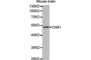 Western Blotting (WB) image for anti-Cannabinoid Receptor 1 (CNR1) (AA 1-120) antibody (ABIN1679303) (CNR1 antibody  (AA 1-120))