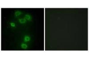 Immunofluorescence analysis of A549 cells, using BMX antibody. (BMX antibody  (N-Term))