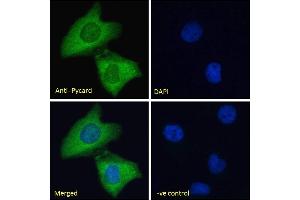 Immunofluorescence (IF) image for anti-PYD and CARD Domain Containing (PYCARD) (Internal Region) antibody (ABIN1590015)