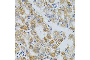 Immunohistochemistry of paraffin-embedded human stomach using PCSK9 antibody (ABIN5975791) at dilution of 1/100 (40x lens). (PCSK9 antibody)