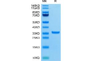 SARS-CoV-2 3CLpro (A191T) on Tris-Bis PAGE under reduced condition. (SARS-Coronavirus Nonstructural Protein 8 (SARS-CoV NSP8) (A191T) Protein)