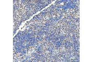 IHC analysis of DDX1 using anti-DDX1 antibody (ABIN7602050). (DDX1 antibody  (AA 562-740))
