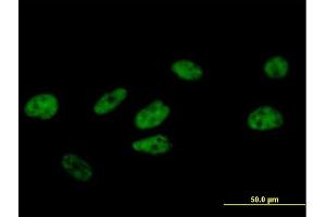 Immunofluorescence of purified MaxPab antibody to FBXO34 on HeLa cell. (FBXO34 antibody  (AA 1-711))