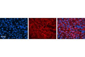DHODH antibody - C-terminal region          Formalin Fixed Paraffin Embedded Tissue:  Human Liver Tissue    Observed Staining:  Cytoplasm in hepatocytes   Primary Antibody Concentration:  1:100    Secondary Antibody:  Donkey anti-Rabbit-Cy3    Secondary Antibody Concentration:  1:200    Magnification:  20X    Exposure Time:  0.