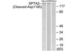 Western blot analysis of extracts from HeLa/A549 cells, treated with etoposide 25uM 24H, using SPTA2 (Cleaved-Asp1185) Antibody. (SPTAN1 antibody  (Cleaved-Asp1185))