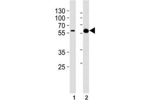 Western blot analysis of lysate from (1) A431 cell line and (2) mouse brain lysate using Pink1 antibody at 1:1000. (PINK1 antibody)