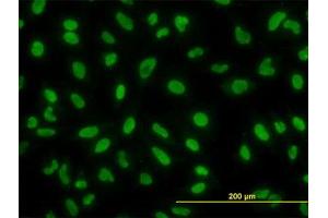 Image no. 2 for anti-YY1 Transcription Factor (YY1) (AA 221-321) antibody (ABIN599012) (YY1 antibody  (AA 221-321))