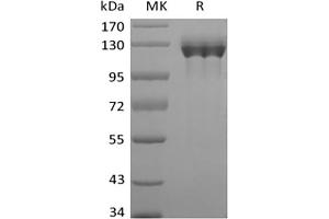 Western Blotting (WB) image for Colony Stimulating Factor 3 Receptor (Granulocyte) (CSF3R) protein (Fc Tag) (ABIN7319762) (CSF3R Protein (Fc Tag))