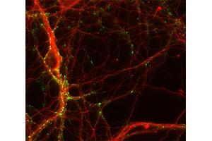 Immunocytochemistry (ICC) image for anti-Tubulin, beta 3 (TUBB3) (AA 443-450) antibody (ABIN1742554) (TUBB3 antibody  (AA 443-450))