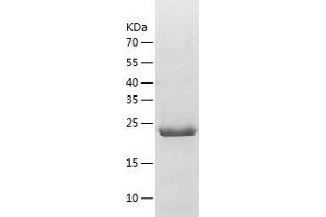 Western Blotting (WB) image for Glutathione S-Transferase mu 5 (GSTM5) (AA 1-218) protein (His tag) (ABIN7123144) (GSTM5 Protein (AA 1-218) (His tag))