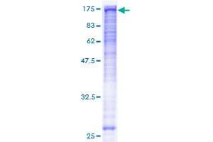 Image no. 1 for Budding Uninhibited By Benzimidazoles 1 Homolog beta (Yeast) (BUB1B) (AA 1-1050) protein (GST tag) (ABIN1346985) (BUB1B Protein (AA 1-1050) (GST tag))
