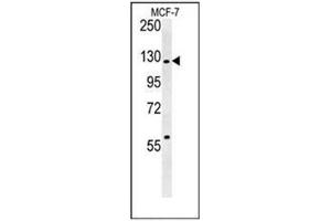 Western blot analysis of RABGAP1 Antibody (N-term) in MCF-7 cell line lysates (35ug/lane).