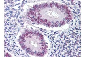 Immunohistochemistry (IHC) image for anti-serine/threonine Kinase 17a (STK17A) (AA 301-414) antibody (ABIN614691) (STK17A antibody  (AA 301-414))