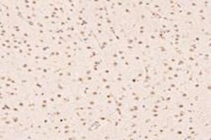 Immunohistochemistry analysis of paraffin-embedded rat substantia nigra using UBLCP1 (ABIN7076132) at dilution of 1: 4200 (UBLCP1 antibody)