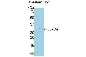 Western blot analysis of the recombinant protein. (EIF2AK2 antibody  (AA 279-506))