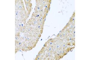 Immunohistochemistry of paraffin-embedded mouse heart using COX6B1 antibody (ABIN5974626) at dilution of 1/100 (40x lens). (COX6B1 antibody)