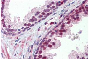 Human Prostate (formalin-fixed, paraffin-embedded) stained with NR0B2 antibody ABIN462246 followed by biotinylated goat anti-rabbit IgG secondary antibody ABIN481713, alkaline phosphatase-streptavidin and chromogen.