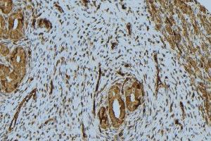 ABIN6276760 at 1/100 staining Human uterus tissue by IHC-P. (NPPA antibody  (C-Term))