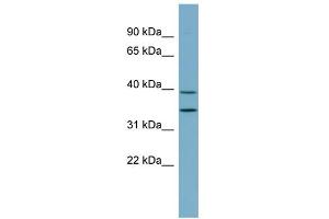 WB Suggested Anti-PRKAB1 Antibody Titration: 0. (PRKAB1 antibody  (N-Term))