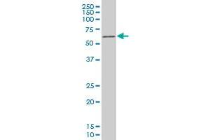 TBX18 monoclonal antibody (M04), clone 3C12 Western Blot analysis of TBX18 expression in Hela S3 NE . (T-Box 18 antibody  (AA 454-560))