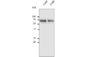 Anti-Albumin Ab at 1/2,500 dilution, 10 µl of diluted human serum per Iane, Rabbit polyclonal to goat IgG (HRP) at 1/10,000 dilution, (Albumin antibody)