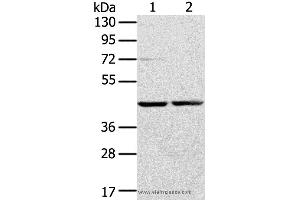 Western blot analysis of Hepg2 and hela cell, using RRAGA Polyclonal Antibody at dilution of 1:400 (RRAGA antibody)