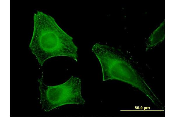 FEM1B antibody  (AA 401-490)